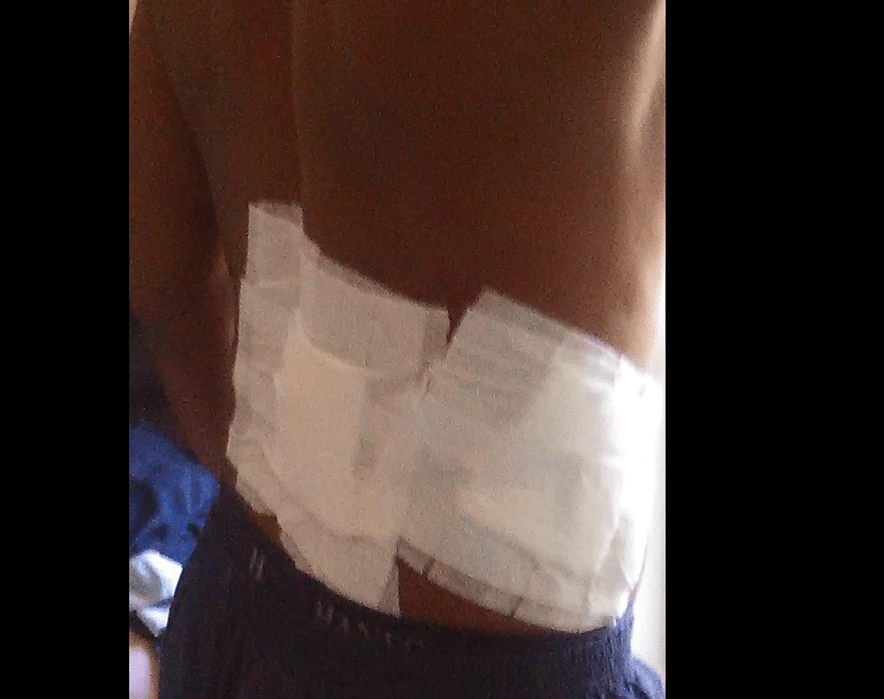 $3 Million Negligent Security Case Result for Gunshot Victim